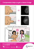 Breast compression poster